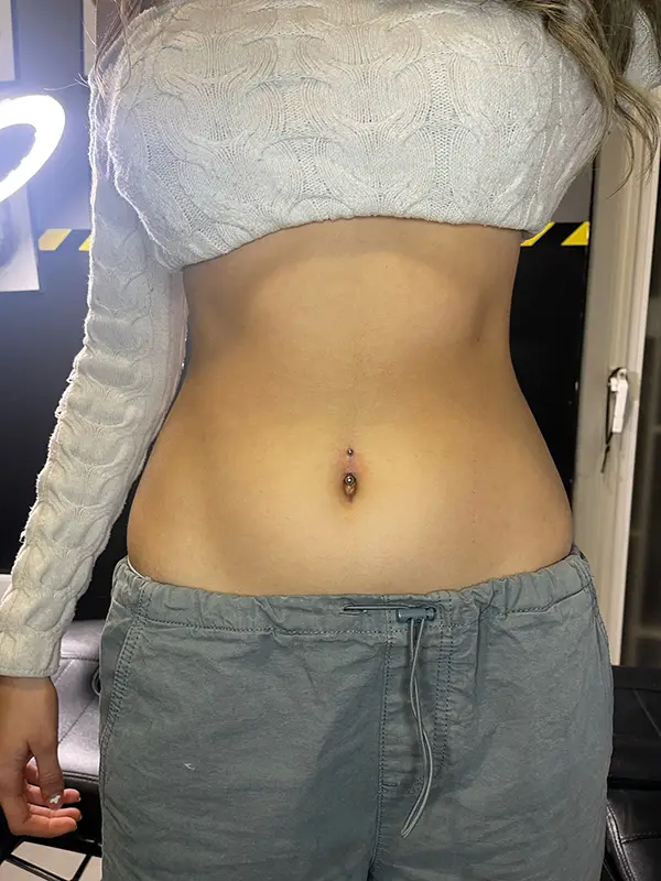Piercing de ombligo con diseño anatómico para evitar el rechazo.